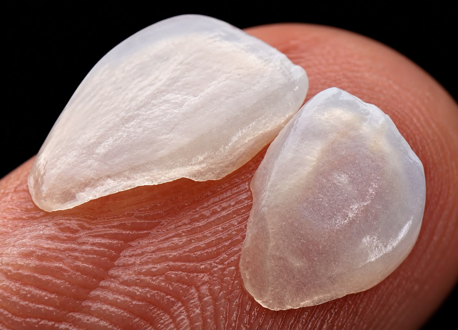 Lentes de porcelana ultrafinas